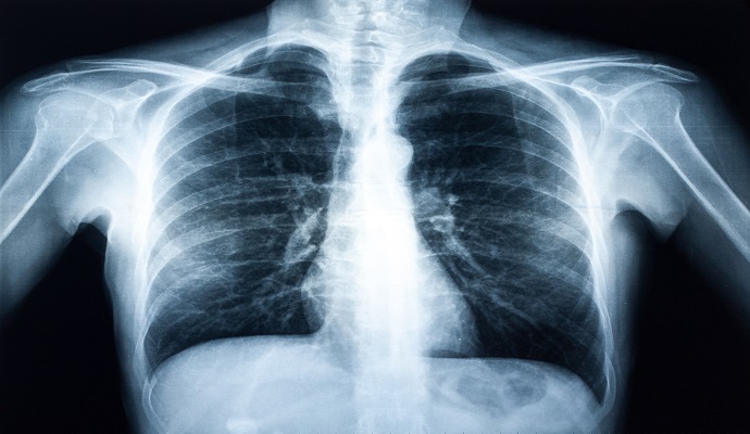 Machine Learning Accurately Triages Respiratory Symptoms in Primary Care